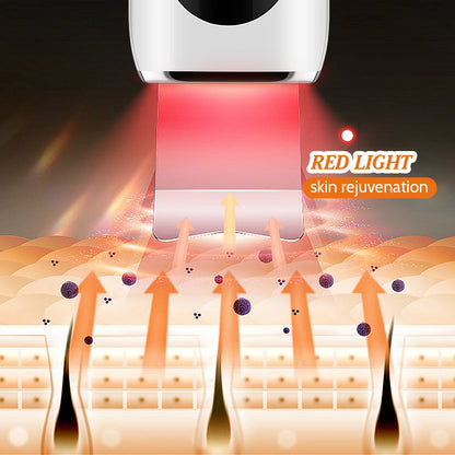 Ultrasonic Face Scrubber and Blackhead Remover