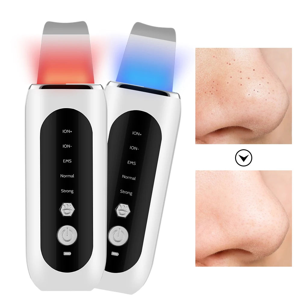 Ultrasonic Face Scrubber and Blackhead Remover