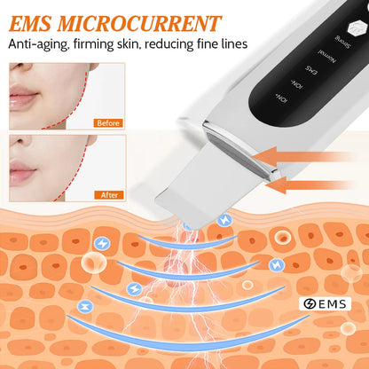 Ultrasonic Face Scrubber and Blackhead Remover
