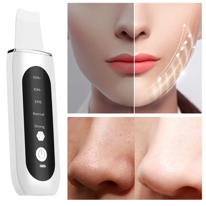 Ultrasonic Face Scrubber and Blackhead Remover